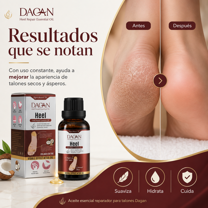 Aceite esencial reparador del talón Dagan